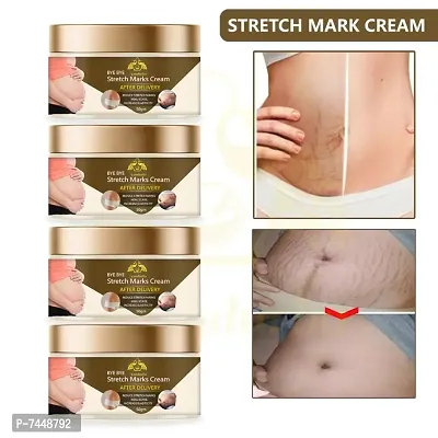 Stretch Marks Cream to Reduce Stretch Marks  Scars 50gm (PACK OF 4)-thumb0