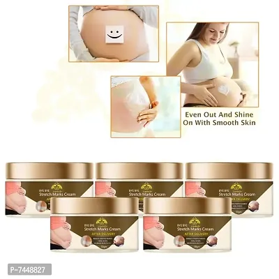 Stretch Marks Cream to Reduce Stretch Marks  Scars 50gm (PACK OF 5)