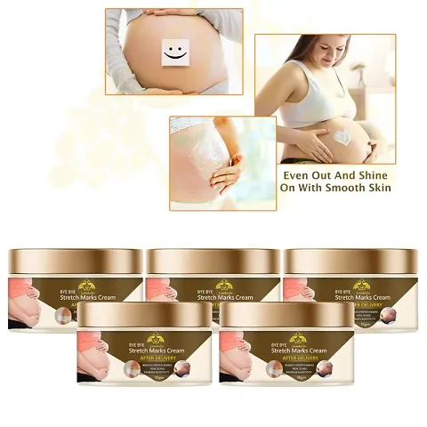 Top Quality Stretch Marks Removal Cream