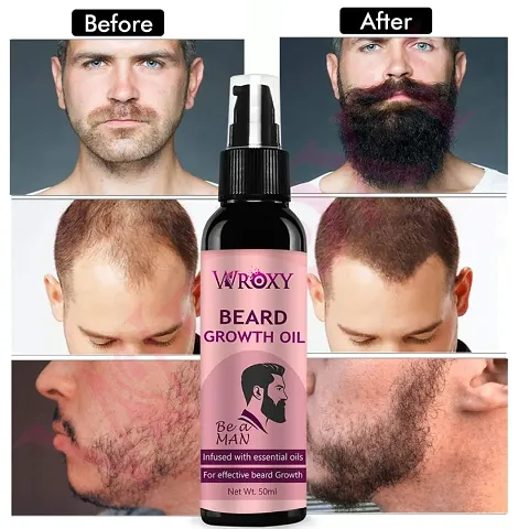 Amazing Quality Beard Oil For Beard Growth
