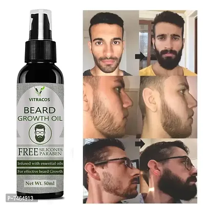 Beard Growth Oil- For Stimulating fast Beard Growth Hair Oil-thumb0