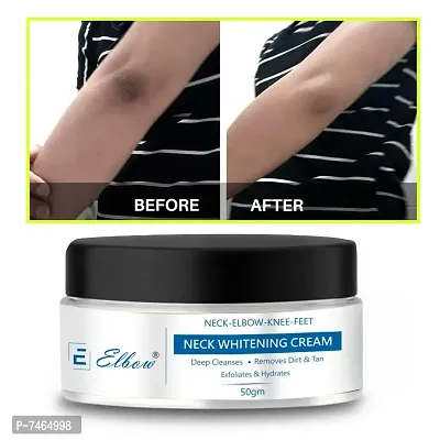 Pure Skin Whitening Cream Look as young as U feel , NOW YOUR SKIN DARKNESS PROBLEM WITING TIME IS OVER WE ARE SERVE YOU BEST BRANDED RESULT BASE PRODUCT.-thumb0