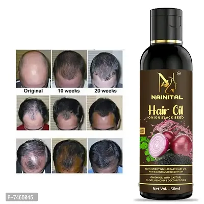 Onion Oil for Hair Regrowth  Hair Fall Control Hair Oil