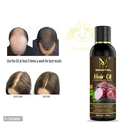 Onion Oil for Hair Regrowth  Hair Fall Control Hair Oil-thumb0