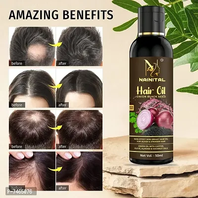 Onion Oil for Hair Regrowth  Hair Fall Control Hair Oil-thumb0