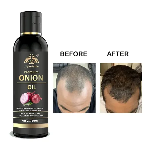 Nandurba Onion Hair Oil&nbsp;Controls Hair Fall