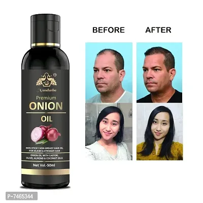 BLACK SEED Onion Hair Oilnbsp;Controls HairFall  Promotes Growth - Hair Oil 50ML