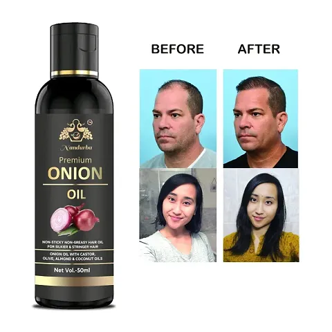 Nandurba Onion Hair Oil&nbsp;Controls Hair Fall