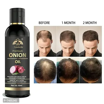 BLACK SEED Onion Hair Oilnbsp;Controls HairFall  Promotes Growth - Hair Oil 50ML