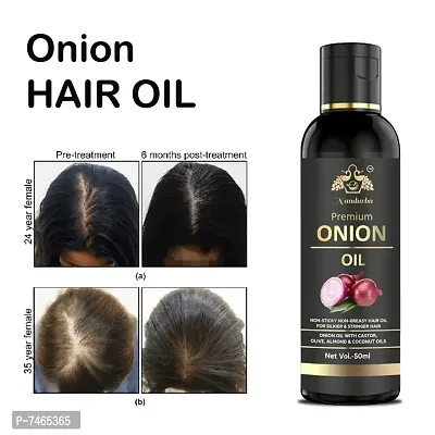 BLACK SEED Onion Hair Oilnbsp;Controls HairFall  Promotes Growth - Hair Oil 50ML