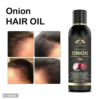 BLACK SEED Onion Hair Oilnbsp;Controls HairFall  Promotes Growth - Hair Oil 50ML