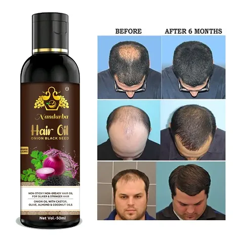 Nandurba Onion Hair Oil&nbsp;Controls Hair Fall