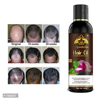 ONION HAIR OIL 50ML PACK OF 1