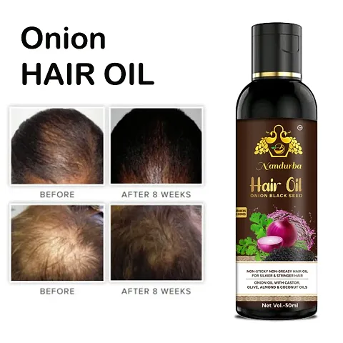 Nandurba Onion Hair Oil&nbsp;Controls Hair Fall