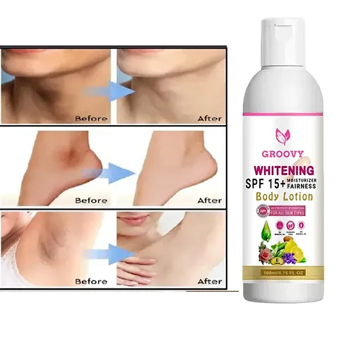 Best Selling Skin Whitening Body Lotion