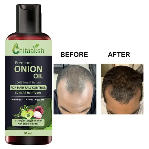 Onion Herbal Hair Oil