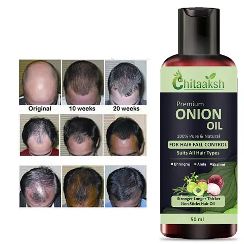 Onion Herbal Hair Oil with 14 Essential Oils for Hair Regrowth