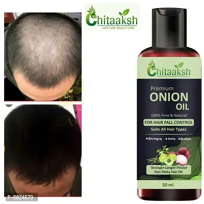 Onion Herbal Hair Oil with 14 Essential Oils for Hair Regrowth Pack 1-thumb0