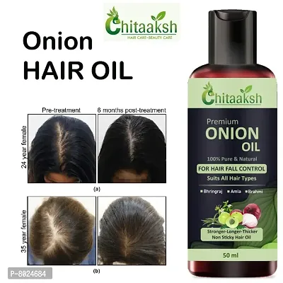 Onion Herbal Hair Oil with 14 Essential Oils for Hair Regrowth Pack 1