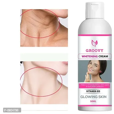 WHITENING CREAM FOR GLOWING SKIN 50ML (PACK OF 1)