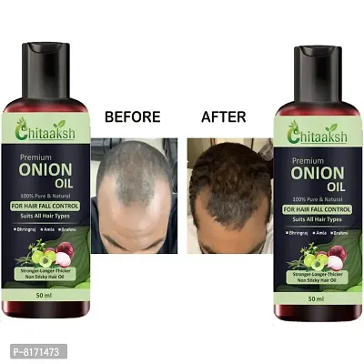 Onion Hair Oil with 14 Essential Oils for Hair Regrowth, Dandruff Control Hair Oil  (50 ml) pack of 2