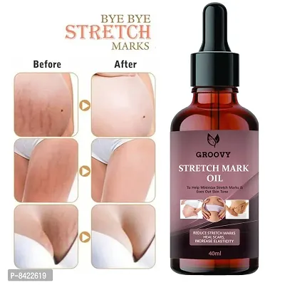Strech Mark Oil For Anti-Strech Mark Cream 40ML (Pack Of 1)