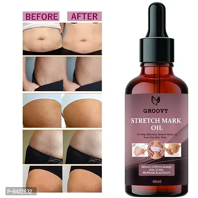 Strech Mark Oil For Anti-Strech Mark Cream 40ML (Pack Of 1)