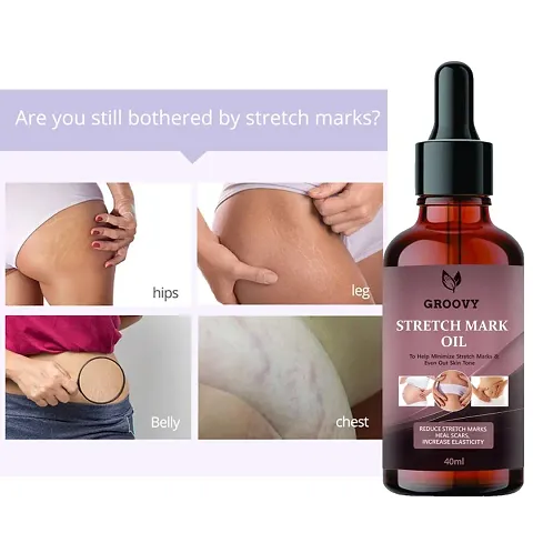 Best Selling Anti-stretch Mark Creams