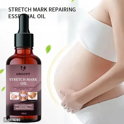 Strech Marks Oil 40Ml Pack Of 1