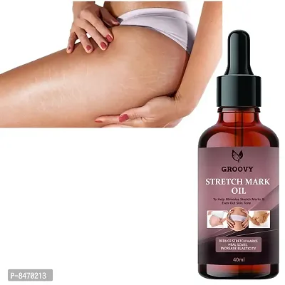 Strech Marks Oil 40Ml Pack Of 1