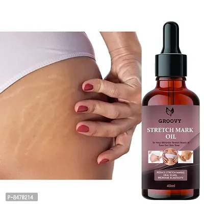 Strech Marks Oil 40Ml Pack Of 1