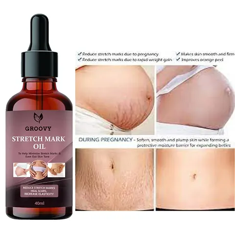 Groovy Stretch Marks Oil