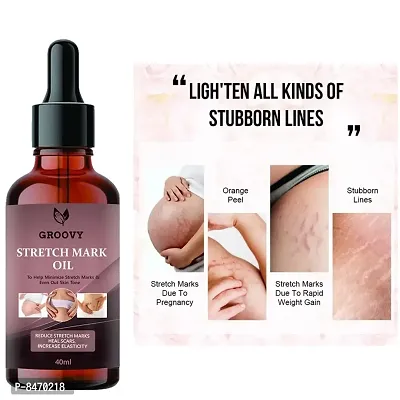 Strech Marks Oil 40Ml Pack Of 1