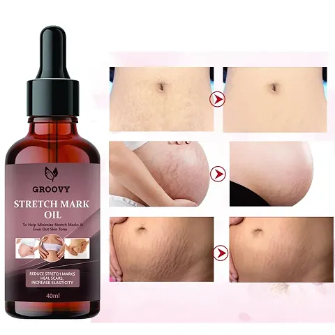Anti Stretch Marks Oil 40Ml Pack Of 1
