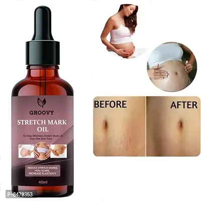 Strech Marks Oil 40Ml Pack Of 1