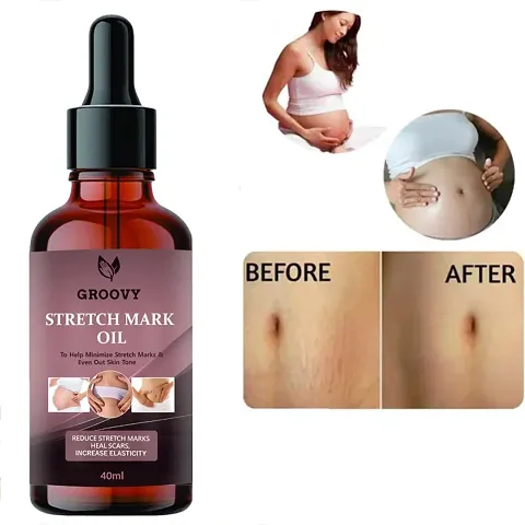 New In Anti-stretch Mark Creams