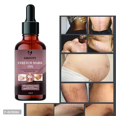 Strech Marks Oil 40Ml Pack Of 1