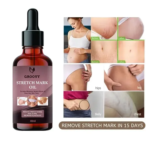 Hot Selling Anti-stretch Mark Creams