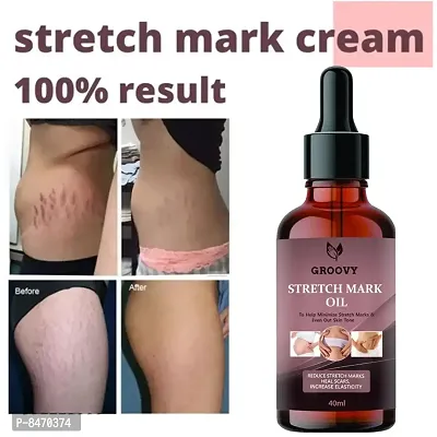 Strech Marks Oil 40Ml Pack Of 1