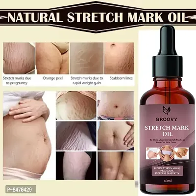 Strech Marks Oil 40Ml Pack Of 1-thumb0