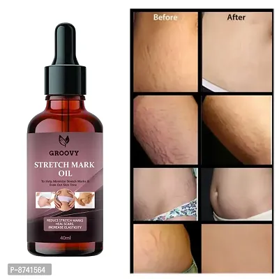 STRETCH MARKS OIL FOR ANTI STRETCH MARK PACK OF 1