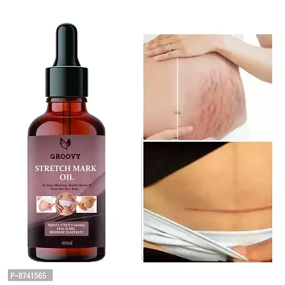 STRETCH MARKS OIL FOR ANTI STRETCH MARK PACK OF 1