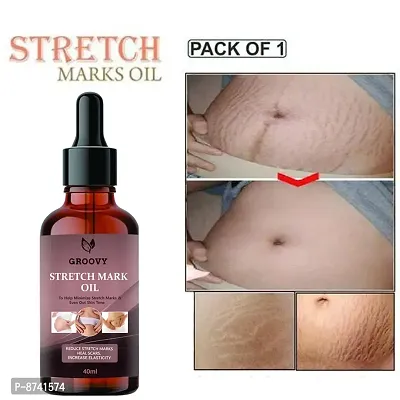 STRETCH MARKS OIL FOR ANTI STRETCH MARK PACK OF 1