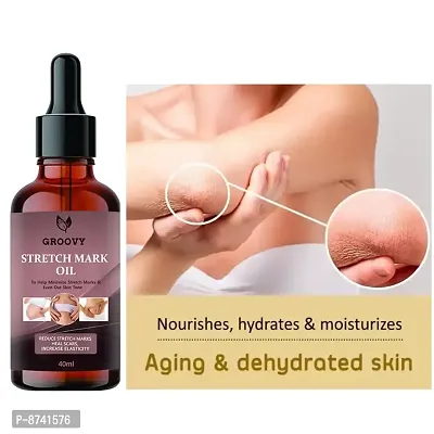 STRETCH MARKS OIL FOR ANTI STRETCH MARK PACK OF 1