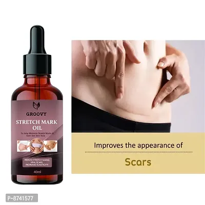 STRETCH MARKS OIL FOR ANTI STRETCH MARK PACK OF 1