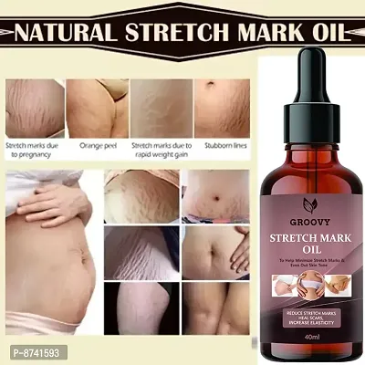 STRETCH MARKS OIL FOR ANTI STRETCH MARK PACK OF 1