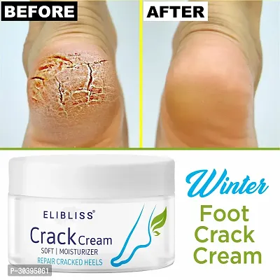 Crack Cream for Dry  Cracked Feet, Moisturizes  Repair Feet for All Skin Type 50gm-thumb2