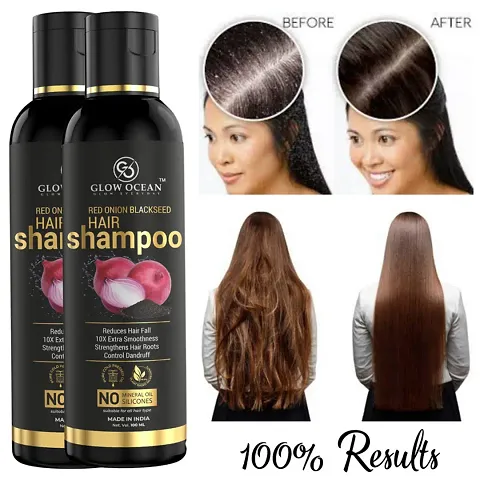 Onion Hair Shampoo For Long, Strong And Shiny Hair