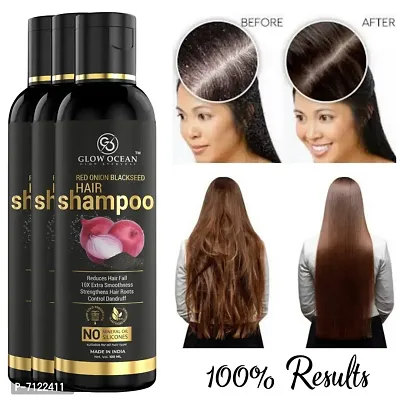 Onion Hair Shampoo Pack Of 3-thumb0