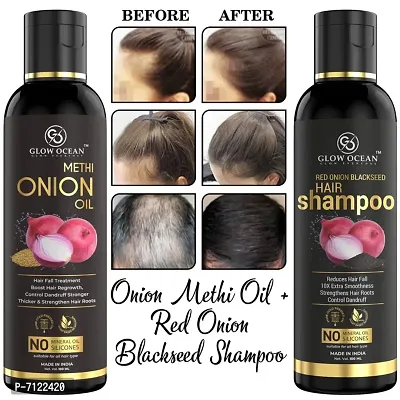 Onion Oil And Hair Shampoo Pack Of 1-thumb0
